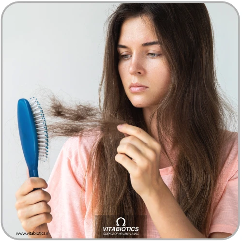 ریزش مو یکی از علائم کمبود آهن در بدن