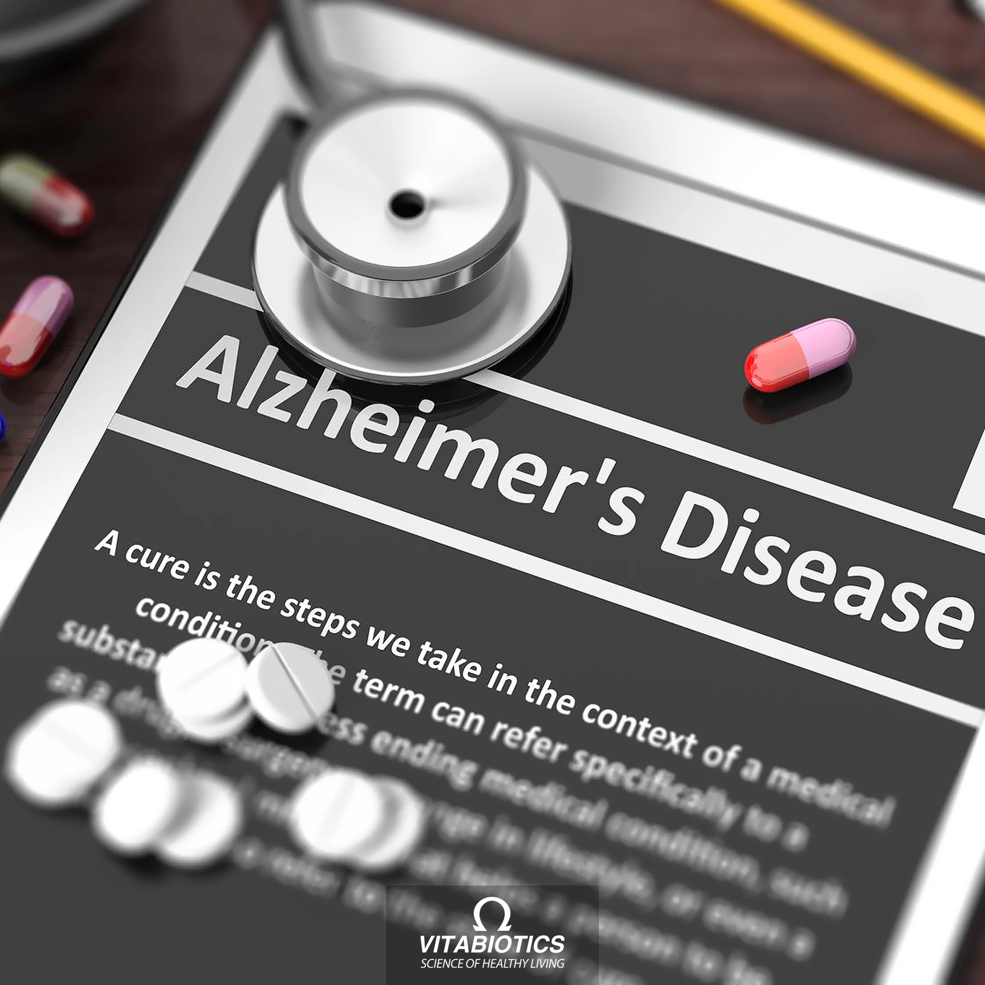 آلزایمر چیست و علائم آن کدام است؟