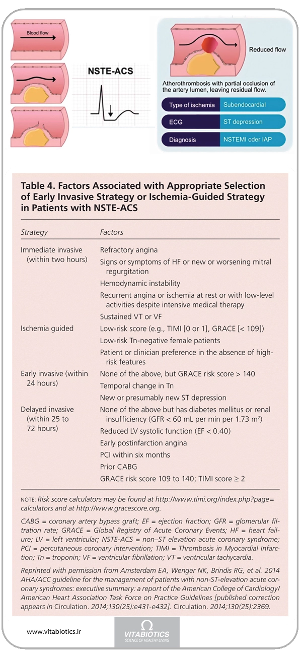 STEMI در مقابل ACS-NSTE 